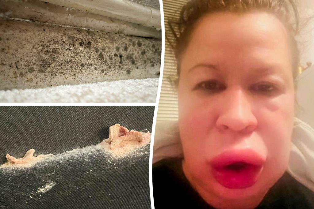 Mom has a terrible allergic reaction to the moldy house, so wet fungi grew up in furniture